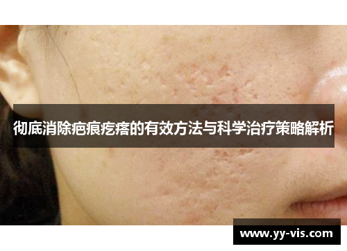 彻底消除疤痕疙瘩的有效方法与科学治疗策略解析