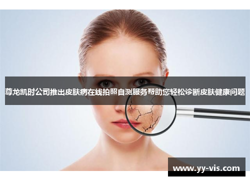 尊龙凯时公司推出皮肤病在线拍照自测服务帮助您轻松诊断皮肤健康问题